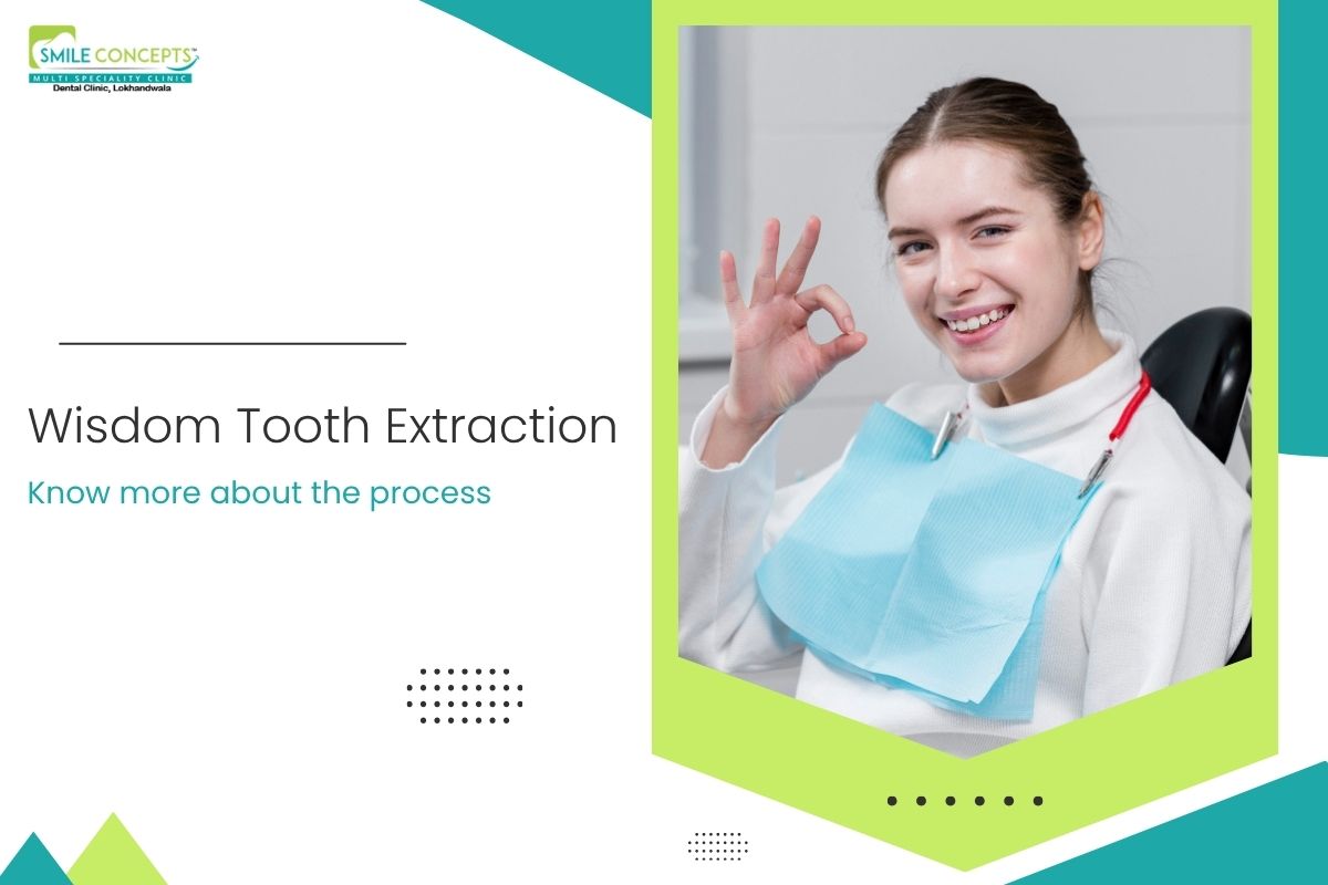Wisdom tooth extraction