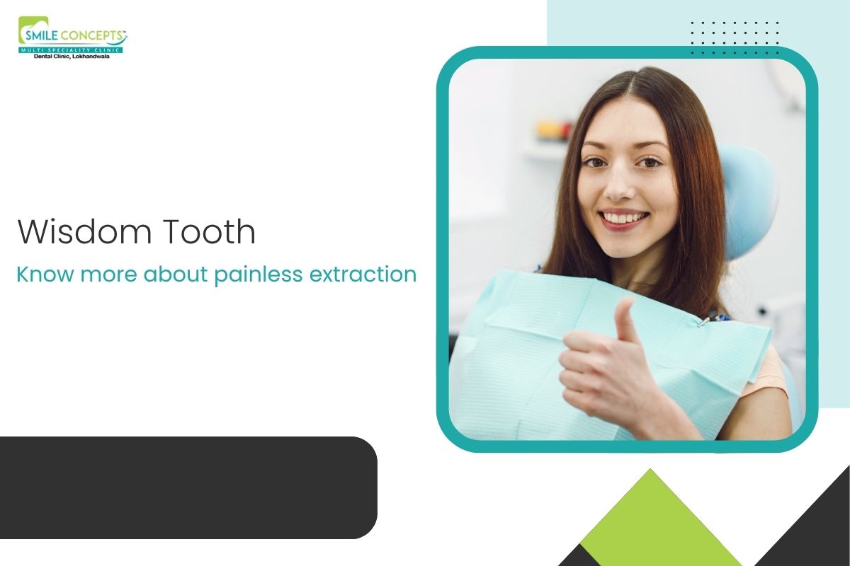 Painless Wisdom tooth removal